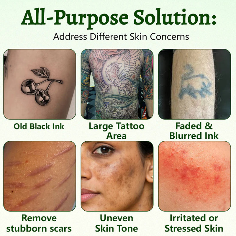 Tattoo Removal Aid Spray – Fades Stubborn Ink