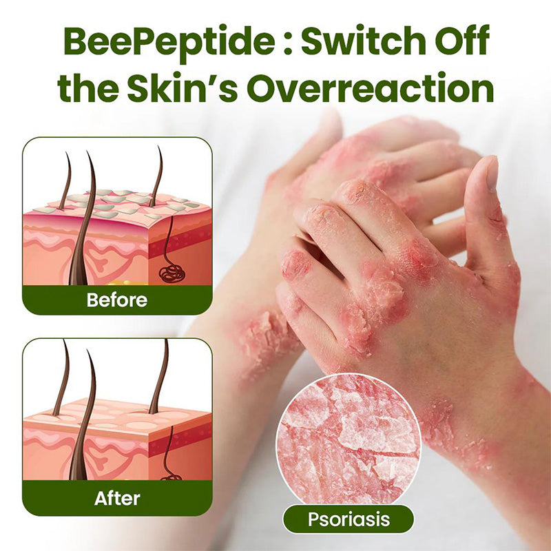 Gentle moisturizing skin care cream