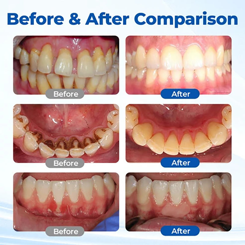 Gum care gel
