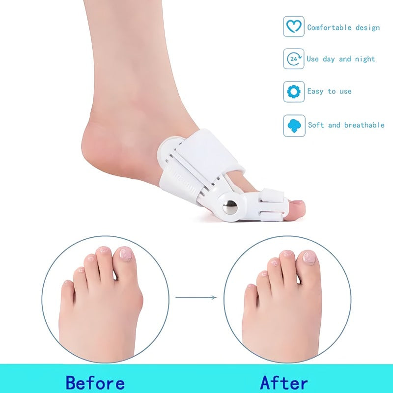 🔥Doctor Recommended🔥 Unisex Bunion Corrector