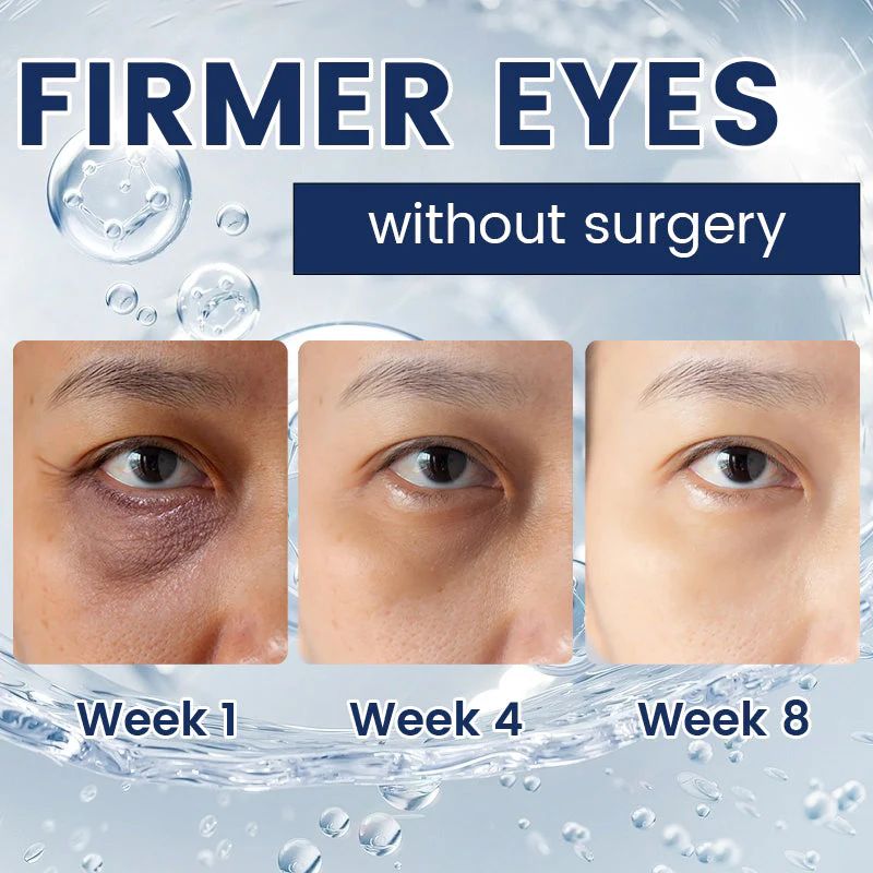 Eye Bag Removal Cream- 💖Buy 1 Get 1 Free (2 PCS)💖