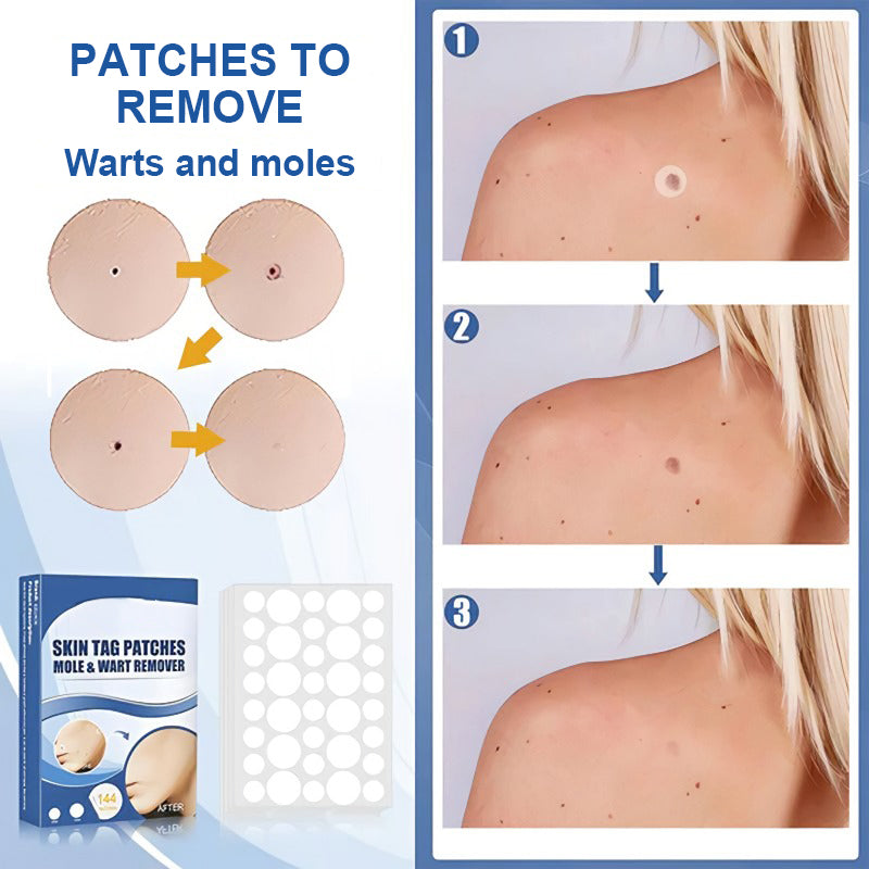 Wart and Mole Removal Patches (Buy 1 Get 1 Free)