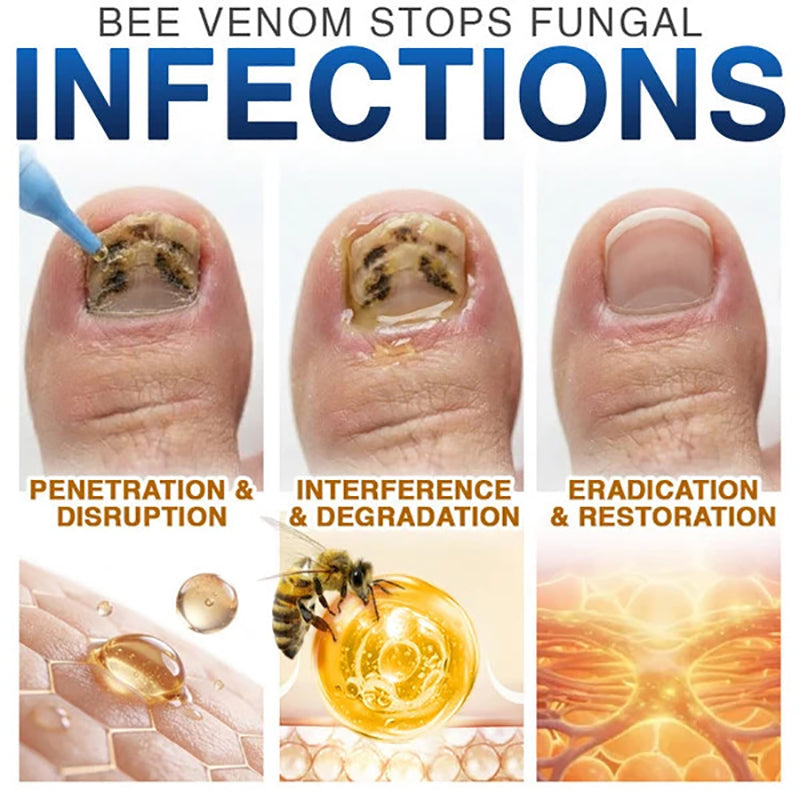 💙 Bee Venom Nail Repair Treatment Agent 🐝