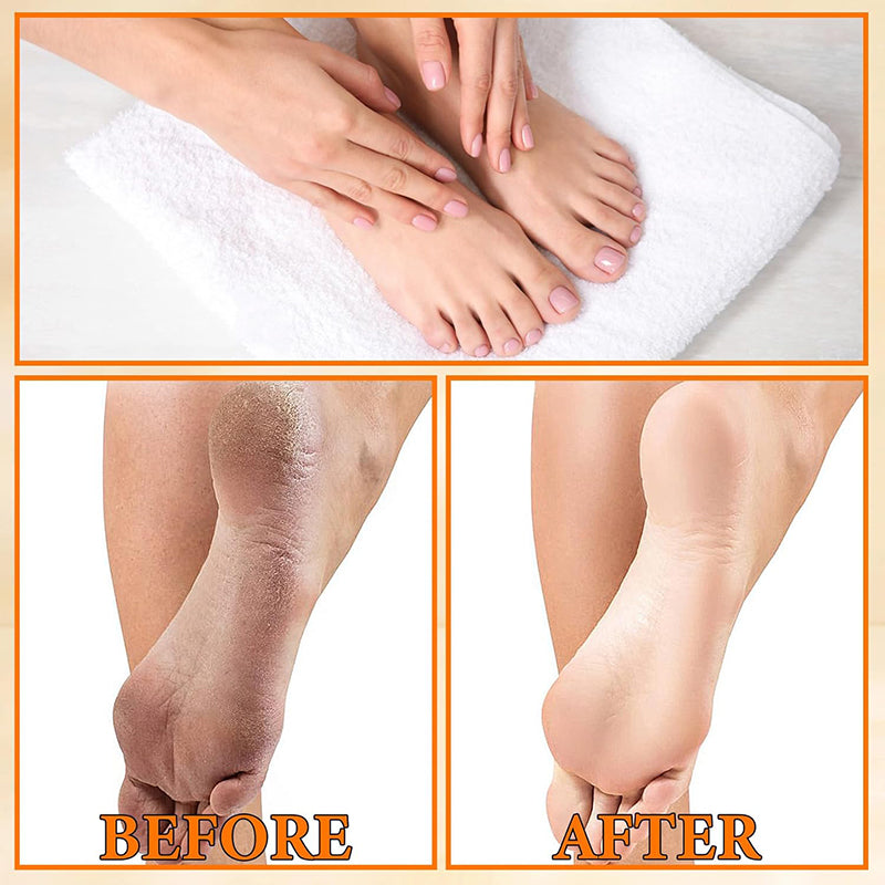 Foot Exfoliating Spray Improves Rough Skin Suitable for the Whole Body