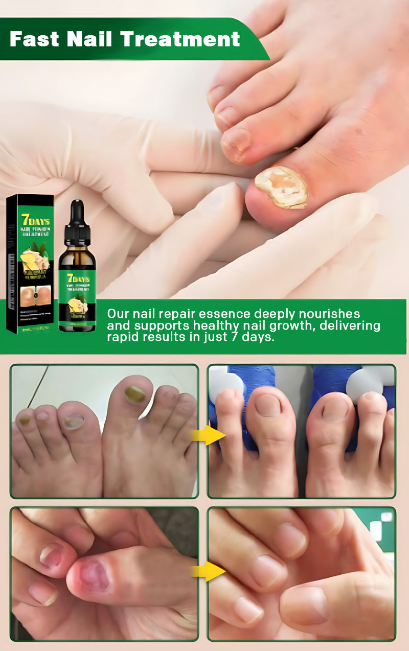 Ginger Nail Care Solution