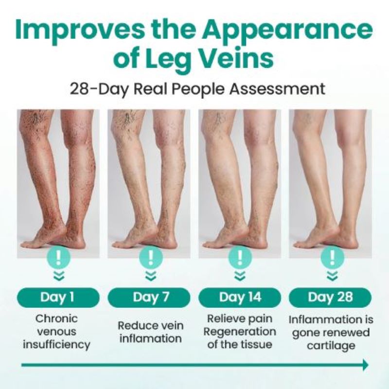 Vein Raised Topical Patch