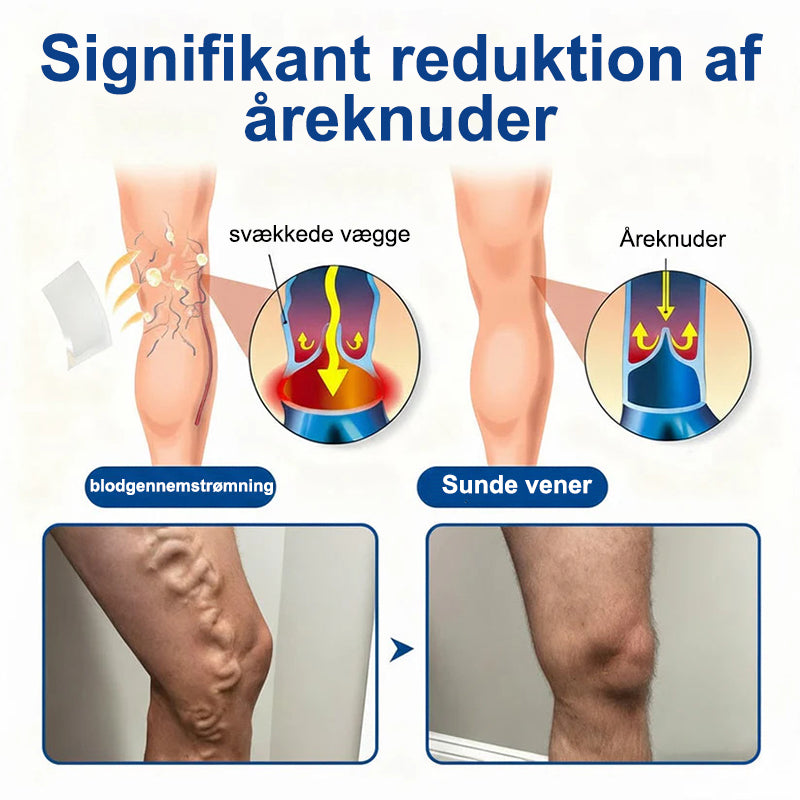 VeinEase mikronålebehandlingsplaster