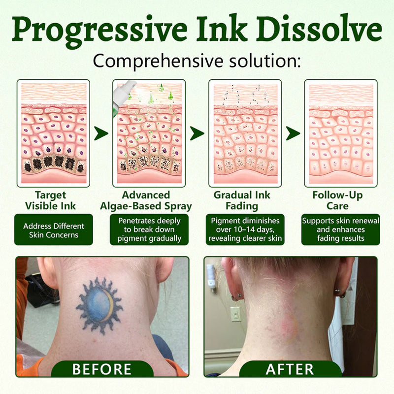 Tattoo Removal Aid Spray – Fades Stubborn Ink