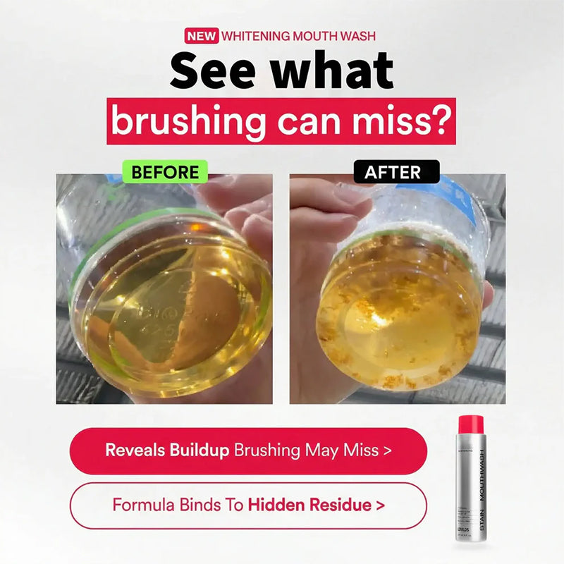 Powerful stain-removing mouthwash – makes teeth whiter with every rinse