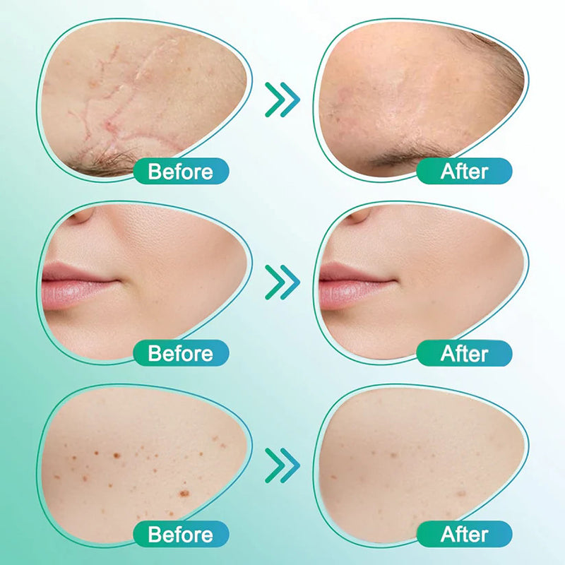 3-in-1 Scar-Fading Skincare Patch
