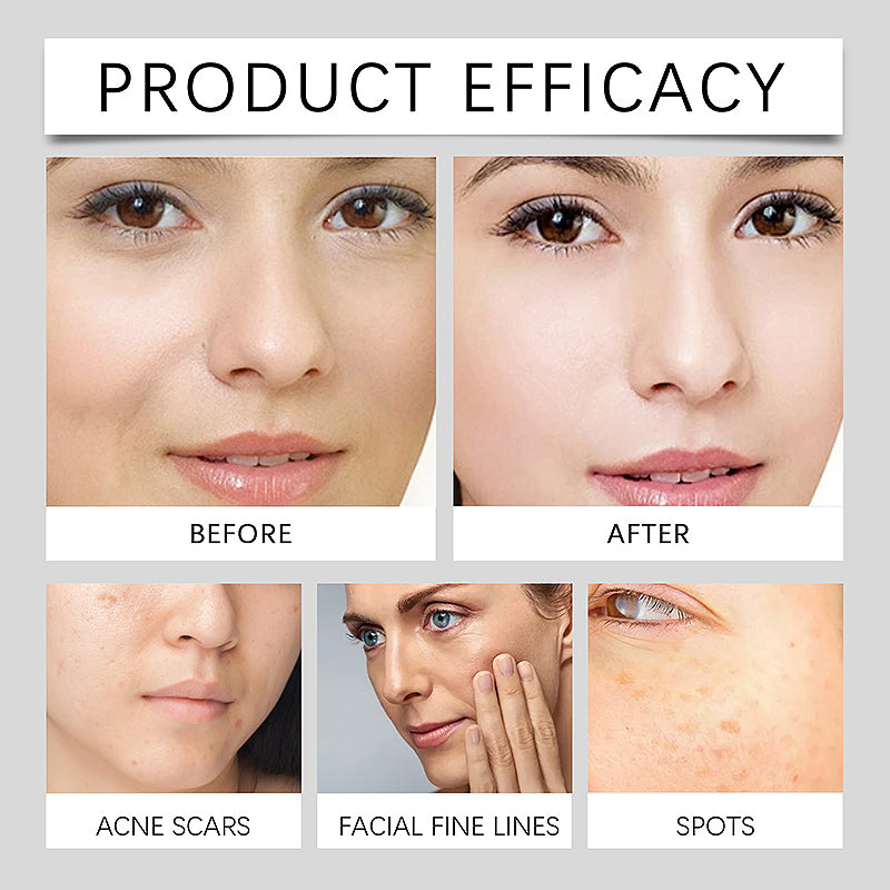 Vitamin C Freckle Whitening Cream - Buy 1 Get 1 Free (2 pcs)