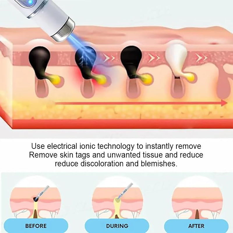 Smoothing Body Skin Care Pen