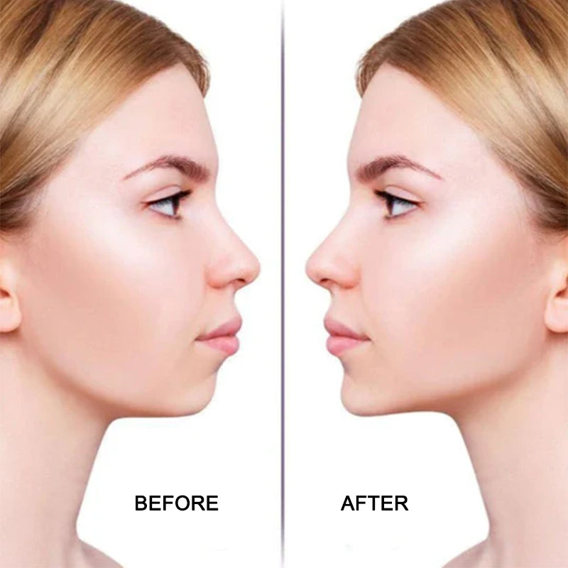 Invisible tape for facelift