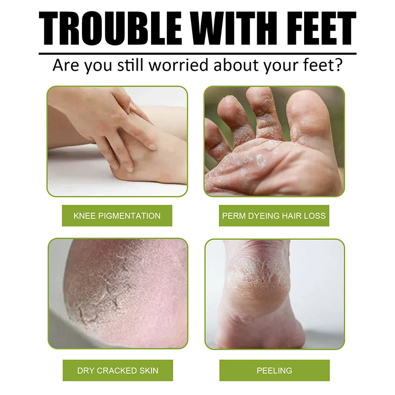 Foot Exfoliating Spray Improves Rough Skin Suitable for the Whole Body