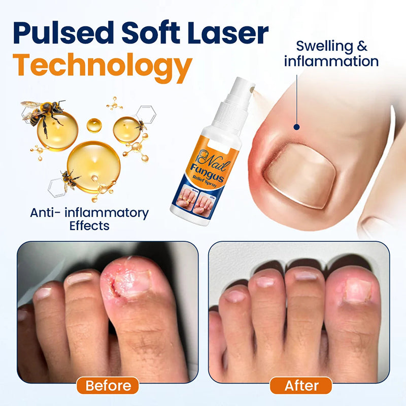 Soothing Nail Spray