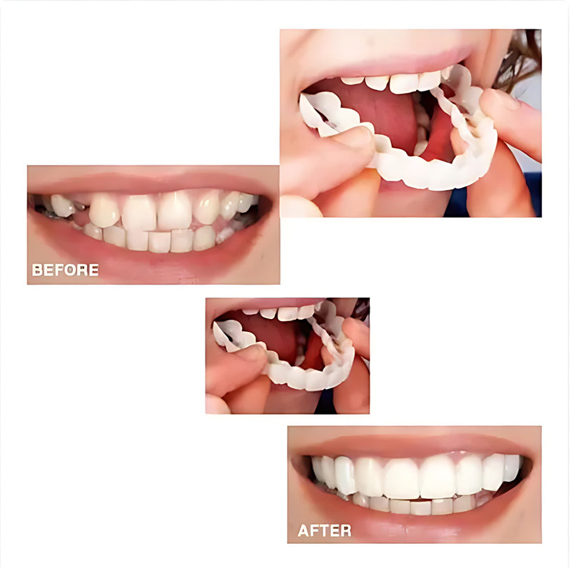 Simulation whitening dentures