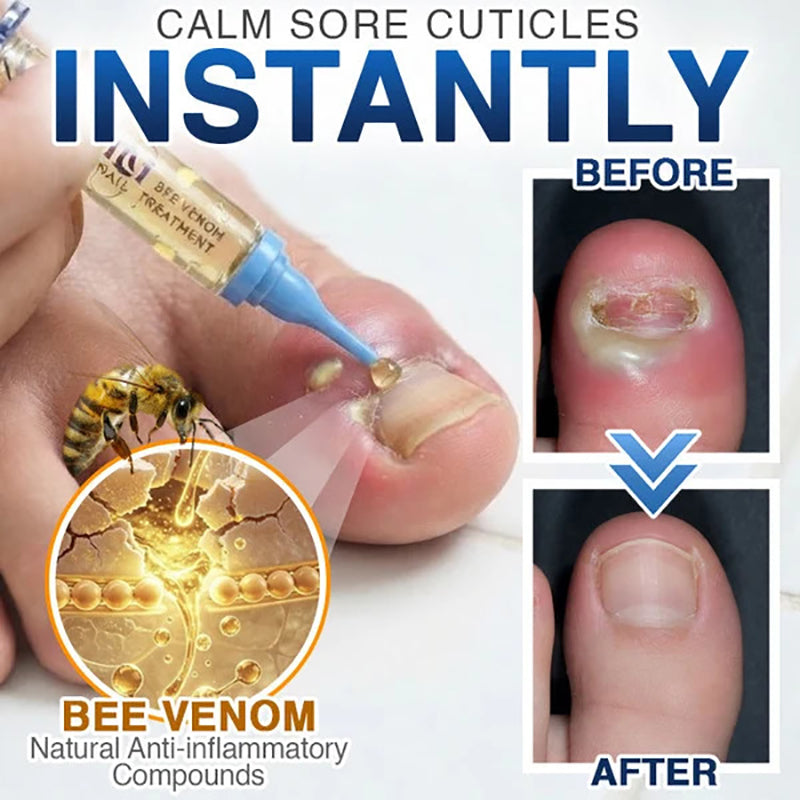 💙 Bee Venom Nail Repair Treatment Agent 🐝