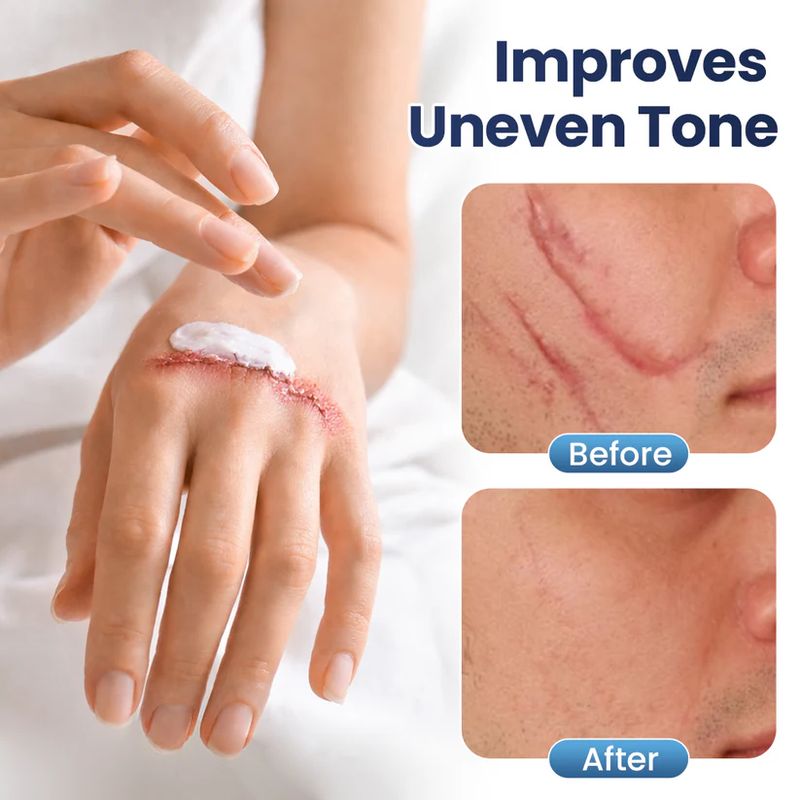 Lavender-textured scar repair gel