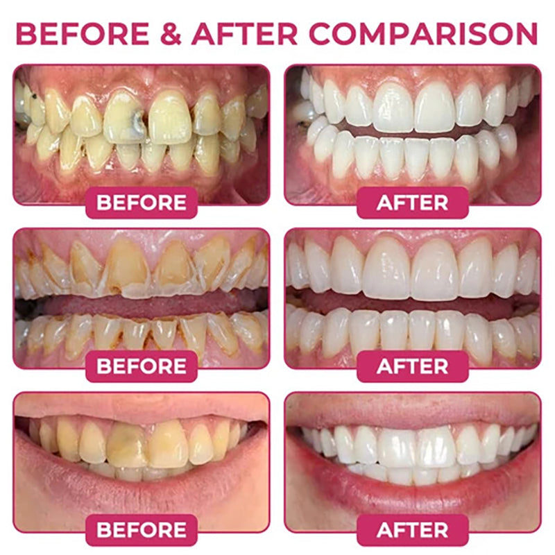 Oral Care Gel