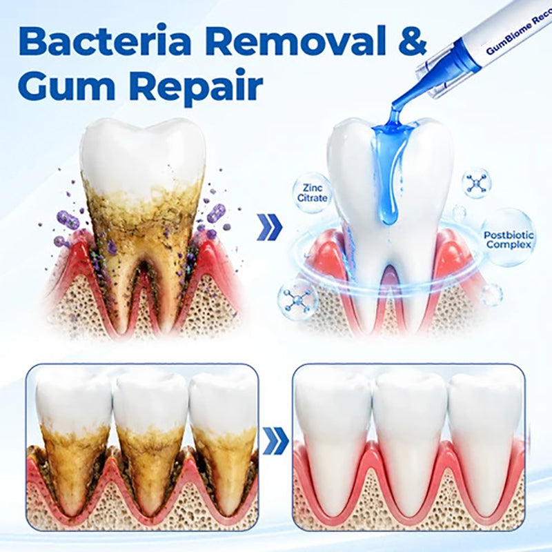 Gum care gel