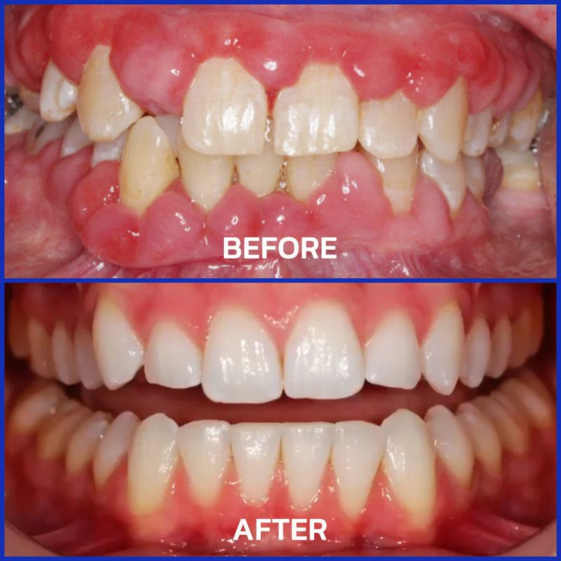 Bee Venom Toothpaste