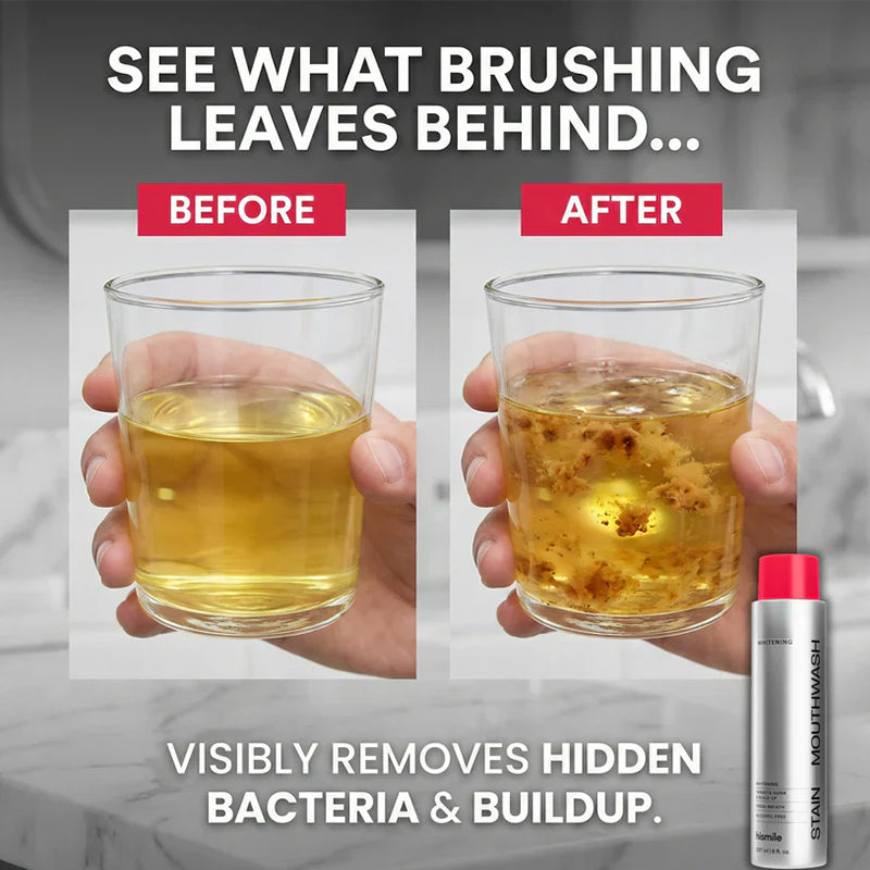 Powerful stain-removing mouthwash – makes teeth whiter with every rinse