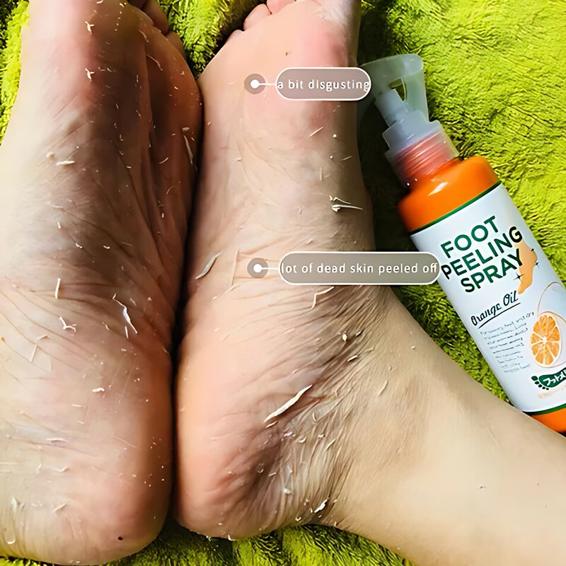 Foot Exfoliating Spray Improves Rough Skin Suitable for the Whole Body