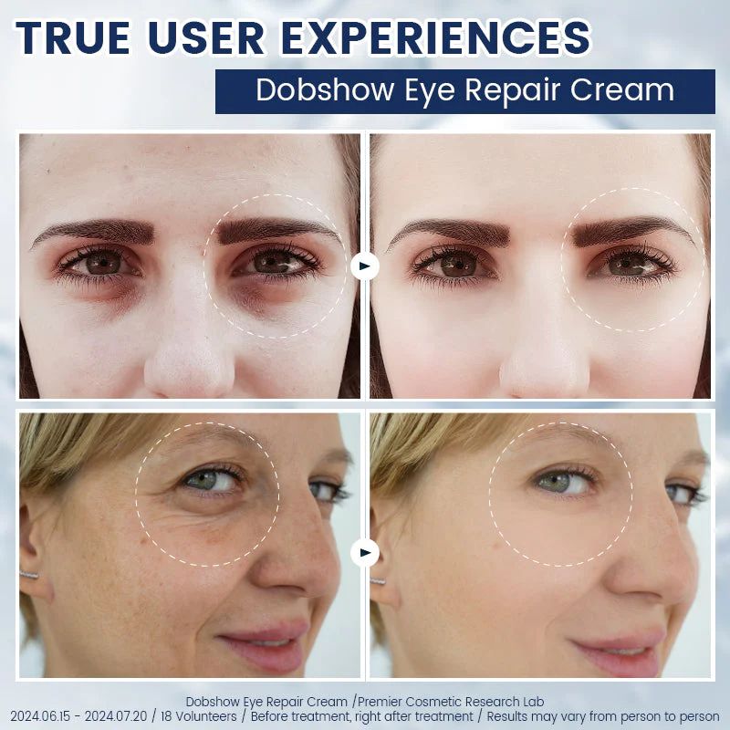 Eye Bag Removal Cream- 💖Buy 1 Get 1 Free (2 PCS)💖