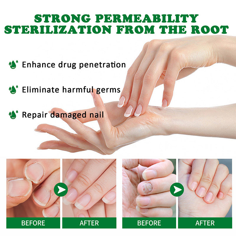 Ginger Nail Care Solution