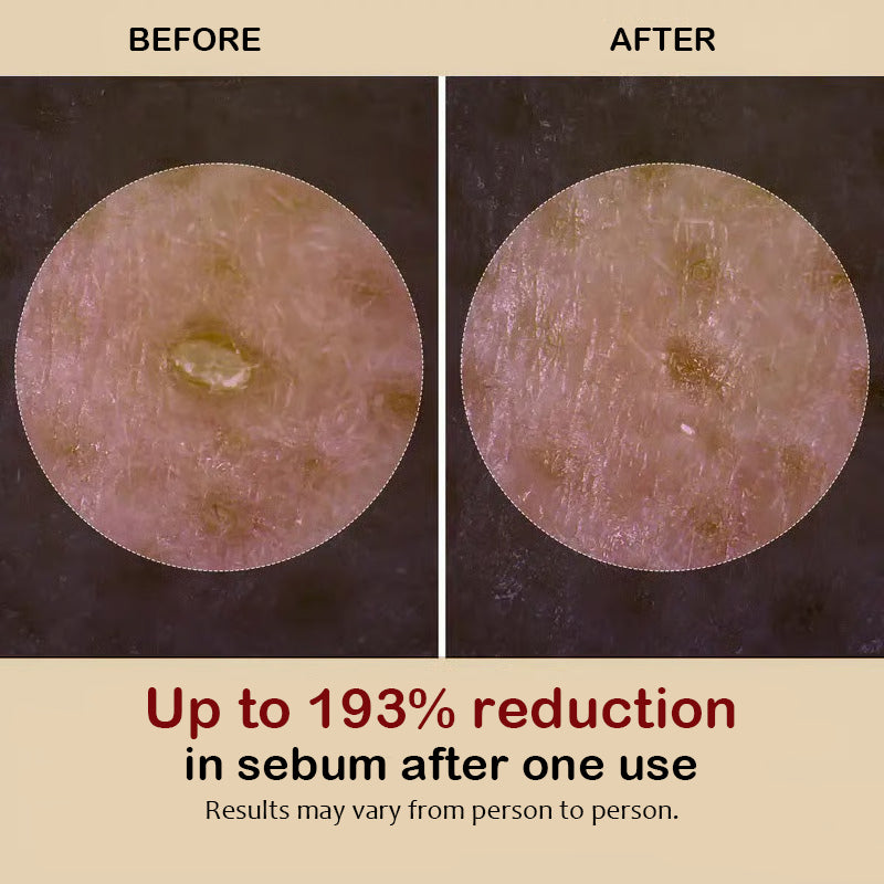 Exfoliating Essence
