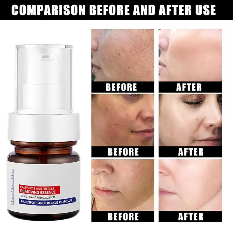 Vitamin C Whitening and Anti-Freckle Cream