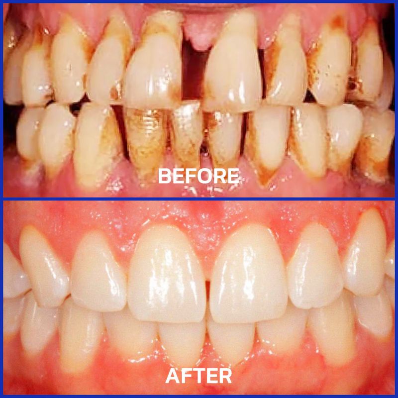 Bee Venom Toothpaste