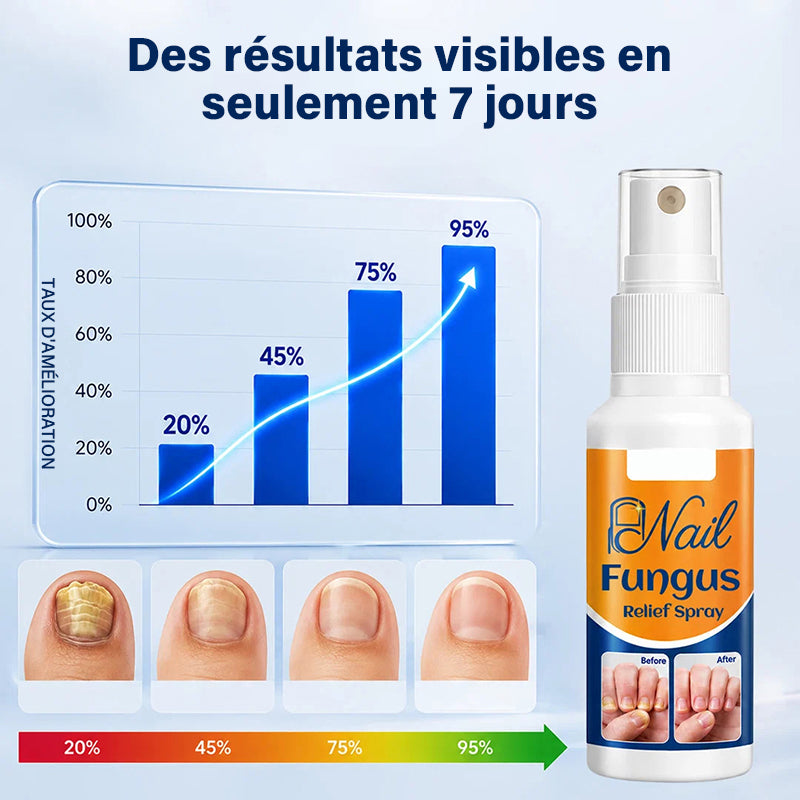 Soothing Nail Spray
