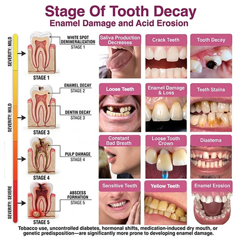 Oral Care Gel