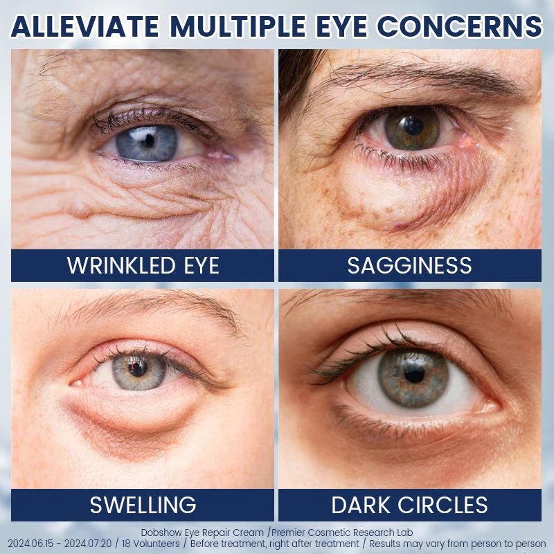 Eye Bag Removal Cream- 💖Buy 1 Get 1 Free (2 PCS)💖