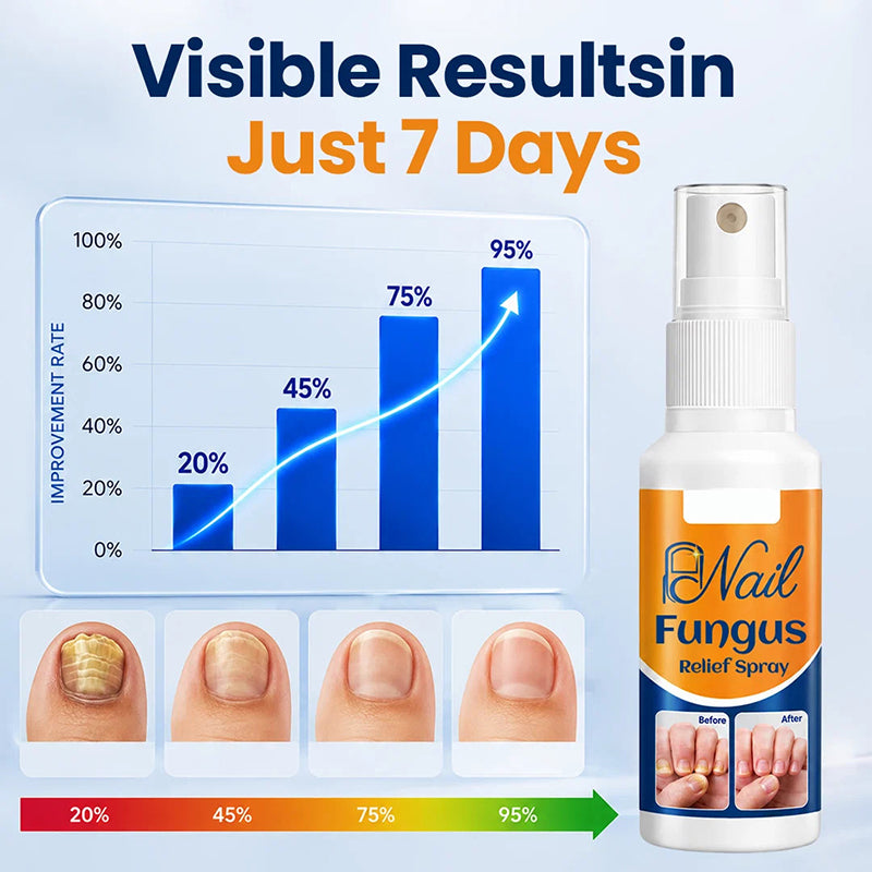 Soothing Nail Spray