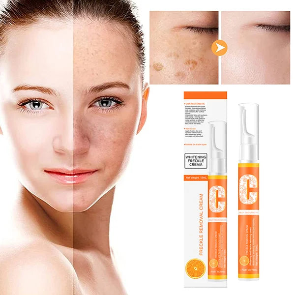 Vitamin C Freckle Dark Spot Removal Cream