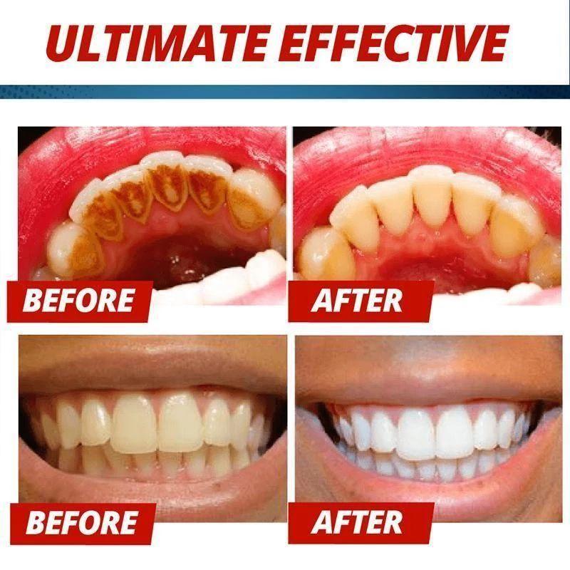 Intensive Stain Removal Whitening Toothpaste