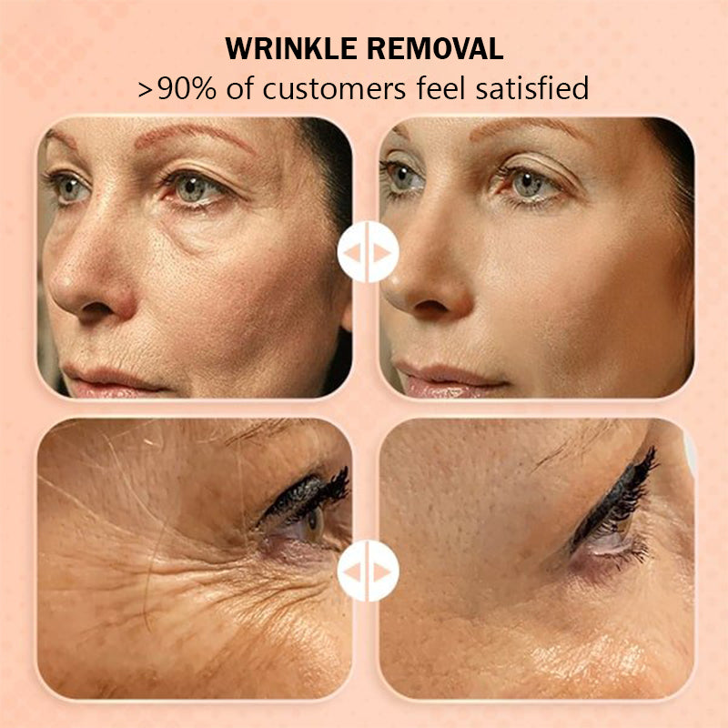 Moisturising anti-wrinkle skin bounce balm