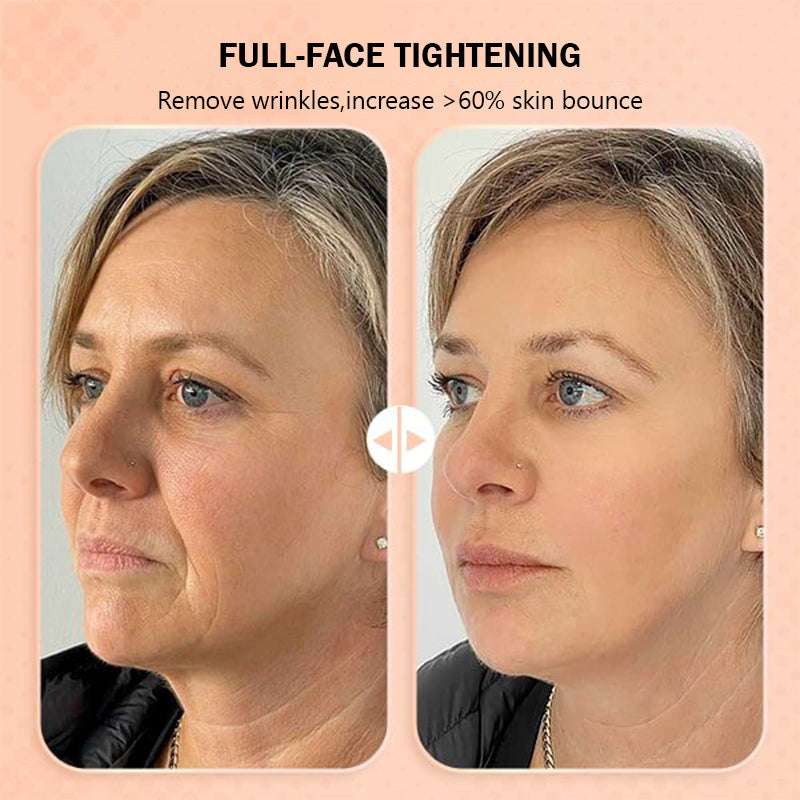 Moisturising anti-wrinkle skin bounce balm