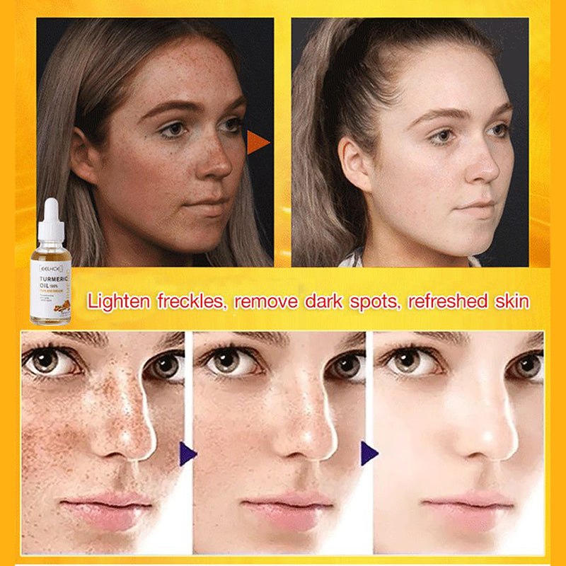 Turmeric Dark Spot Repairing Serum-BUY 1 GET 1 FREE(2 PCS)