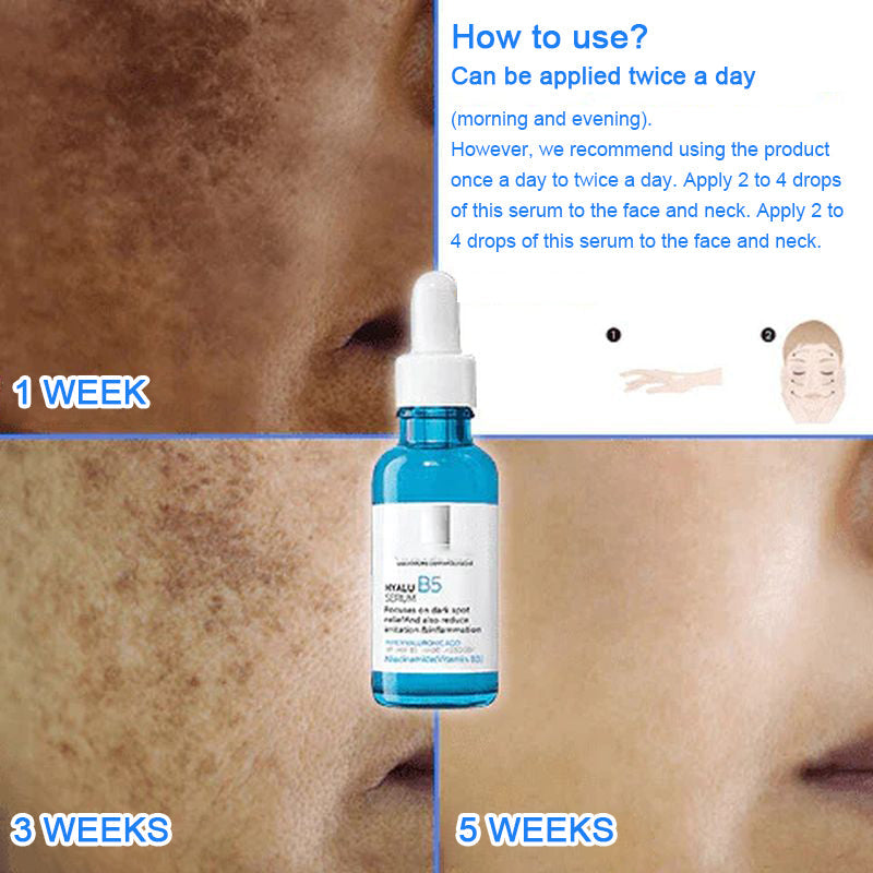 Serum to remove blemishes and acne