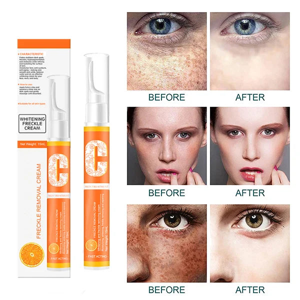 Vitamin C Freckle Dark Spot Removal Cream