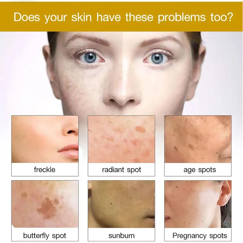 Turmeric Dark Spot Repairing Serum-BUY 1 GET 1 FREE(2 PCS)