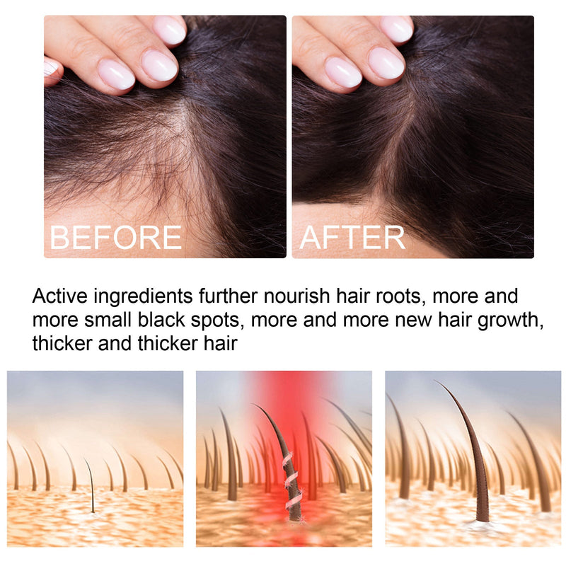 Hair Growth Ginger Spray