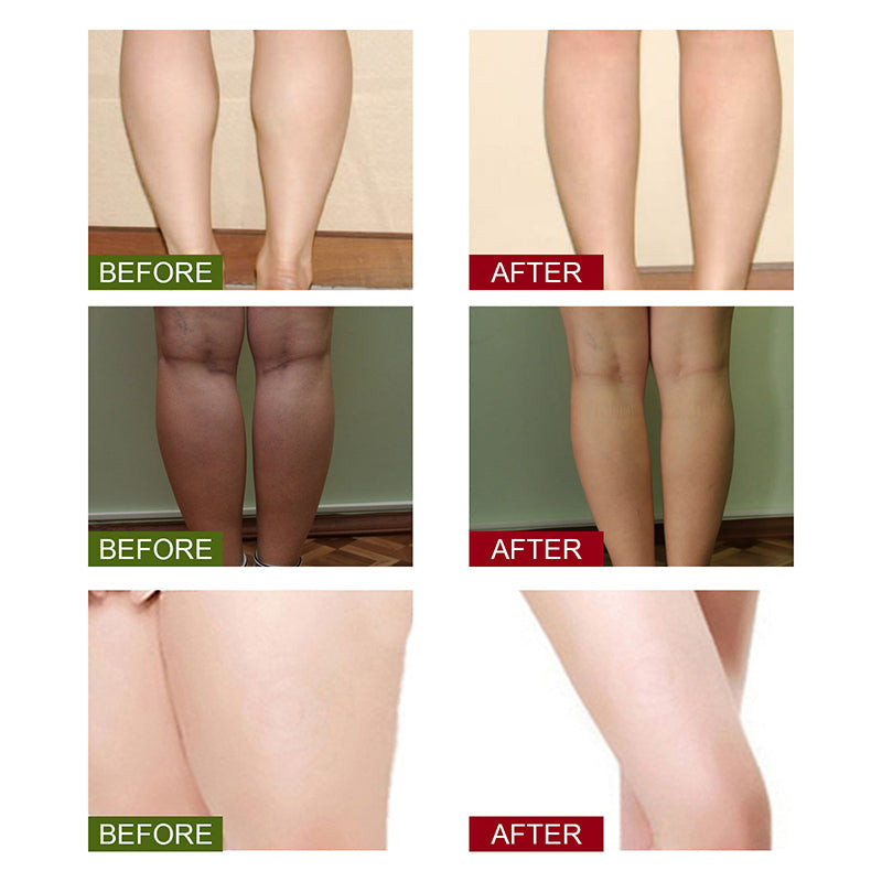 Wormwood Warming Foot Patch